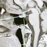 The Science of Meditation: How It Affects Your Brain